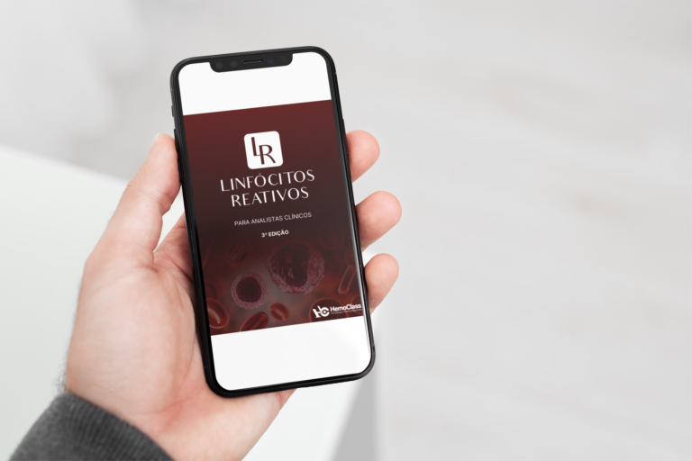 Linfocitos Reativos para Analistas Clínicos – 3ed.