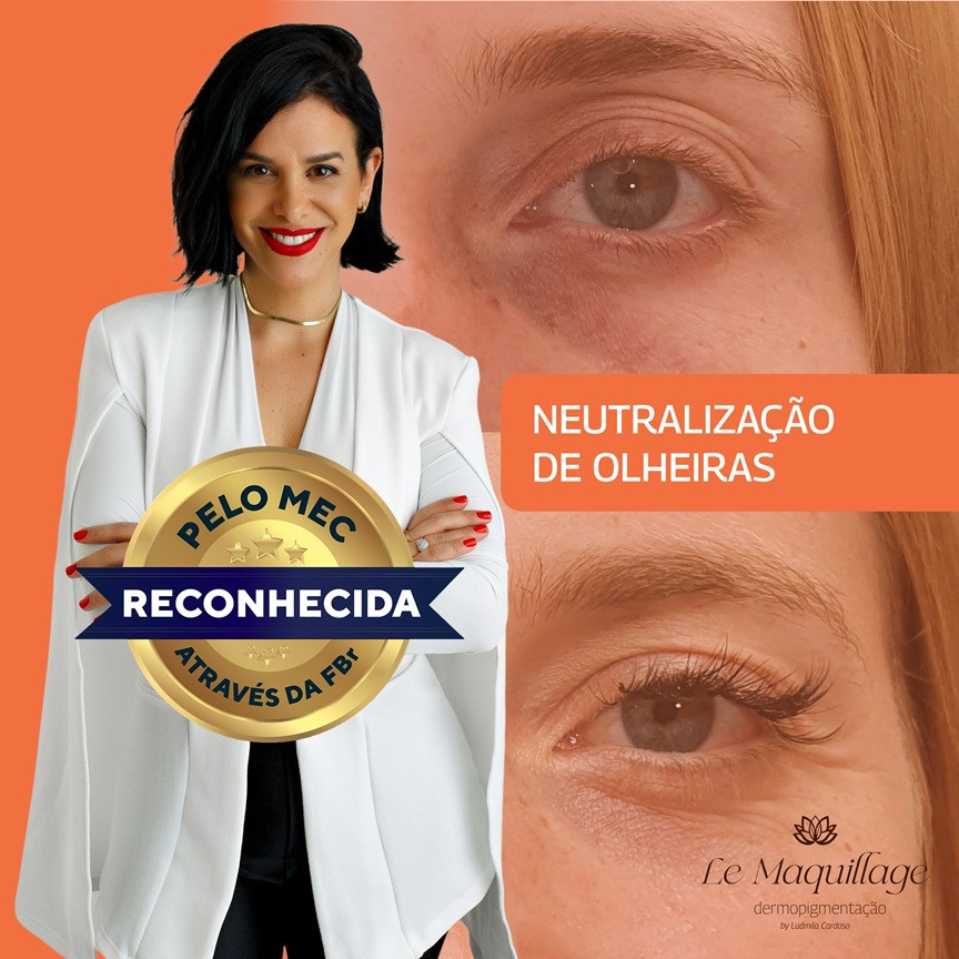 NEUTRALIZACAO-DE-OLHEIRAS-por-LUDMILA-CARDOSO Estética: Domine a Neutralização de Olheiras com Ludmila Cardoso
