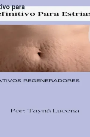 Curso Tratamento Definitivo para Estrias – Reduza até 98%