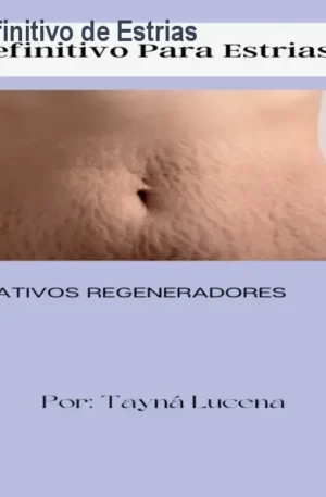Curso Tratamento Definitivo de Estrias – Reduza Marcas
