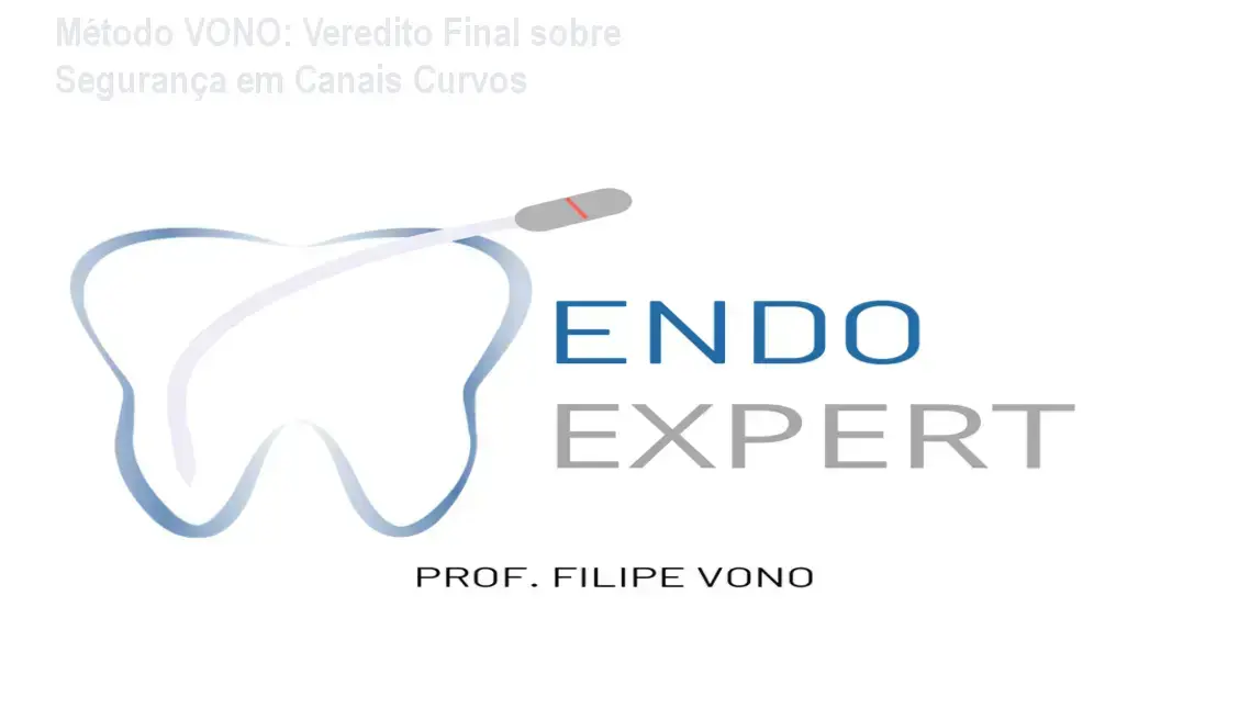 Método VONO do Dr. Filipe: visão interna do kit de limas e metodologia de instrumentação